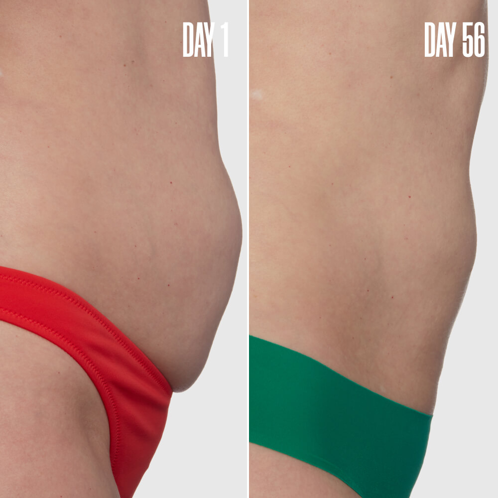 The Loose Skin Bundle package